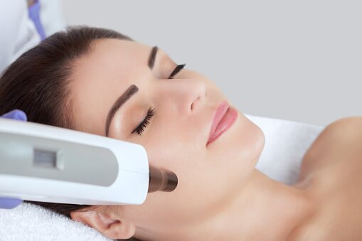 CO2 laser treatment